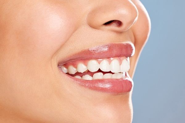 How Does In Office Professional Teeth Whitening Work?